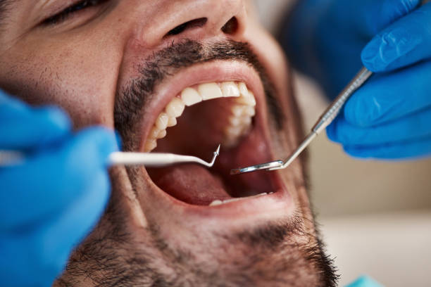 Best Cosmetic Emergency Dentistry in Lake Lotawana, MO